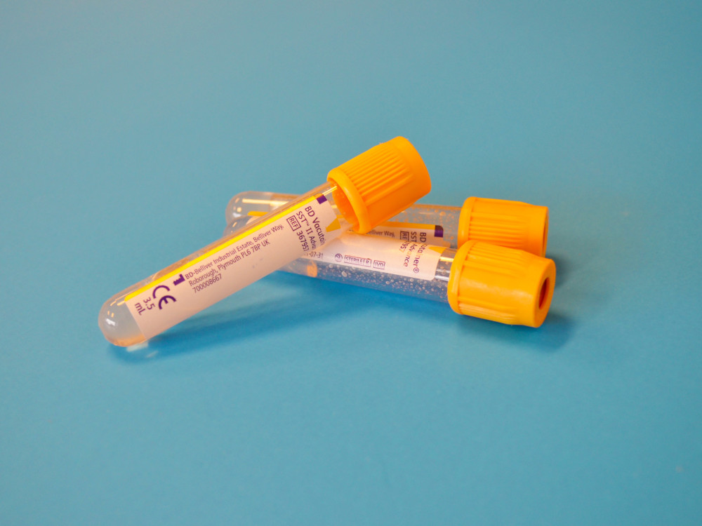 Image of vaccine tubes